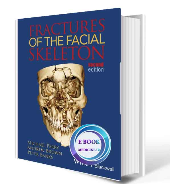 دانلود کتاب Fractures of the Facial Skeleton  (ORIGINAL PDF)